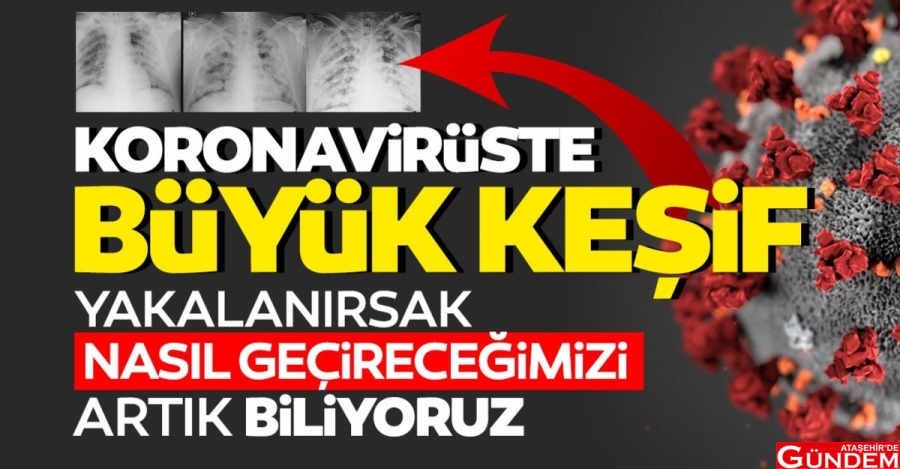 BU GENE SAHİPSENİZ VİRÜS SİZDE FARKLI SEYREDİYOR 1200x627-1607485167890